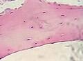 Cartilagine